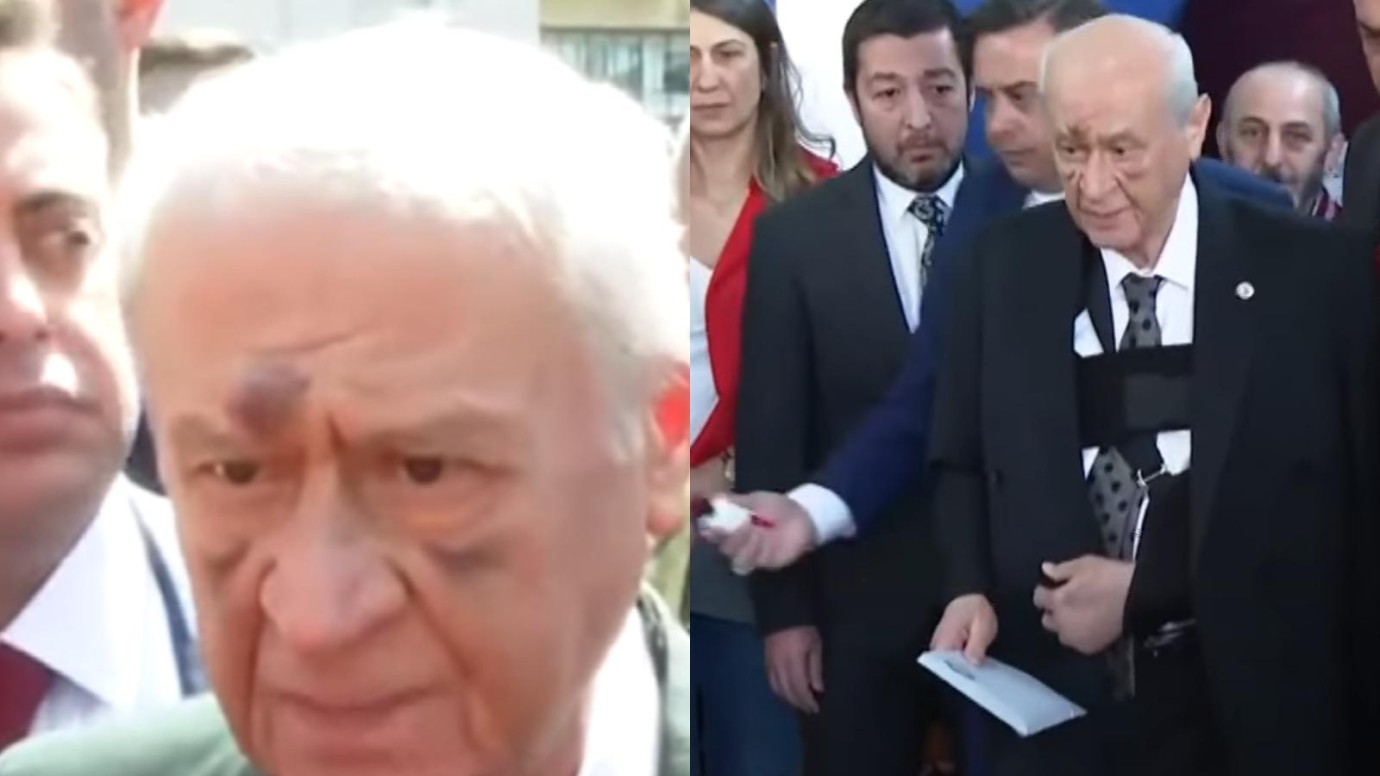 Devlet Bahçeli ne oldu? Sandık başına gelen Devlet Bahçeli kaza mı geçirdi?