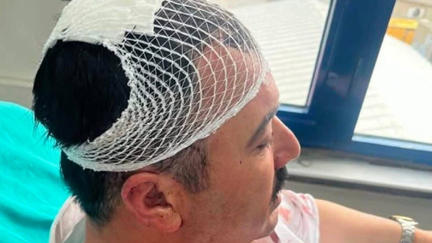 Başkan Yardımcısı’nı Şekerlikle Yaraladı